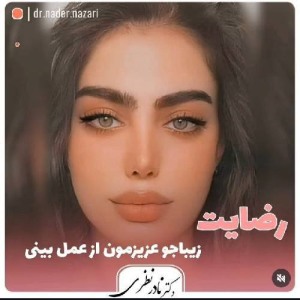 جراحی-بینی-پنج