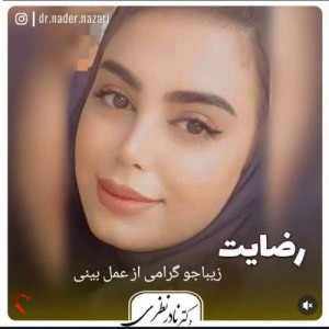 1_جراحی-بینی-4