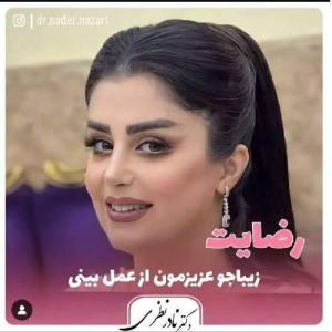 1_جراحی-بینی-5