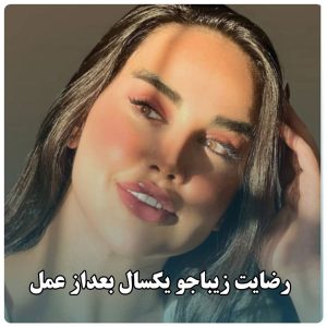 نمونه کار عمل بینی دکتر نادر نظری 