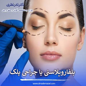 بلفاروپلاستی یا جراحی زیبایی پلک _ دکتر نادر نظری