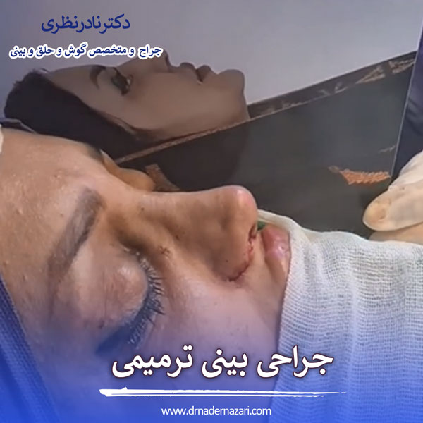 جراحی بینی ترمیمی در کرمانشاه _ دکتر نادر نظری