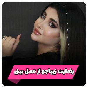 عکس نمونه کار از رضایت زیباجو از جراحی بینی