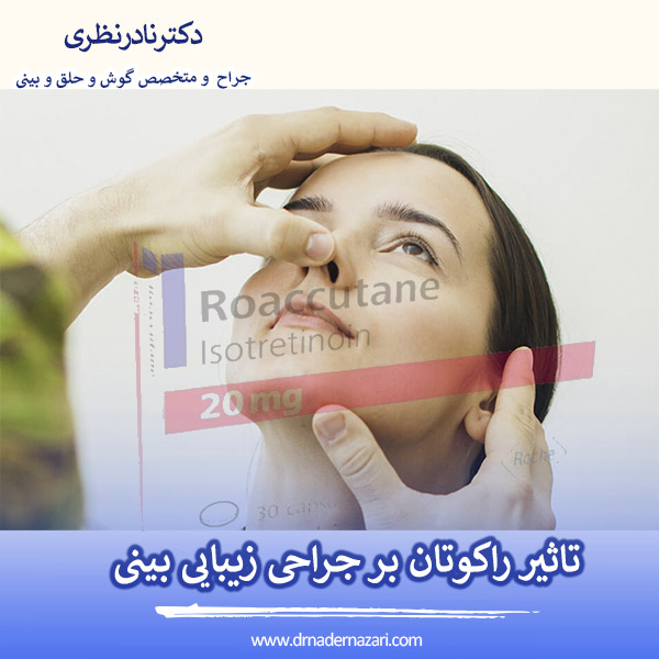 تاثیر راکوتان بر جراحی زیبایی بینی - دکتر نادر نظری