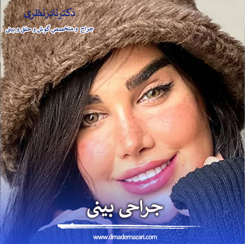 بهترین جراح بینی کرمانشاه - دکتر نادر نظری