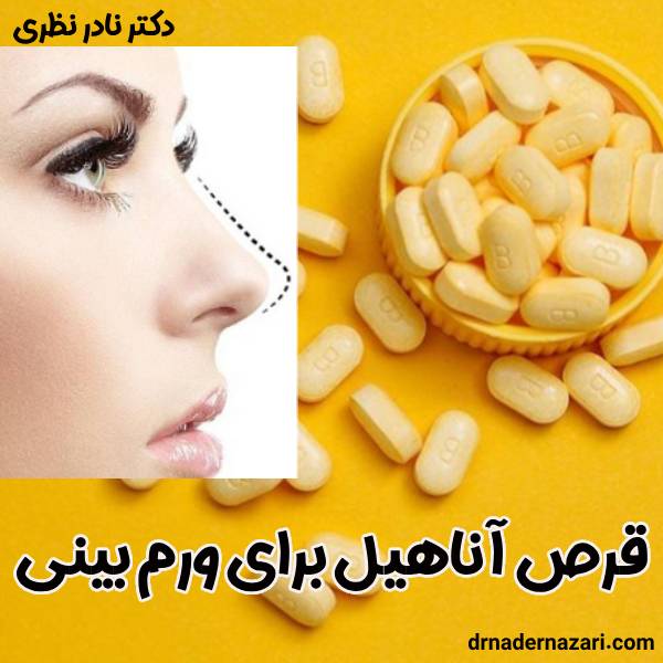 قرص آناهیل برای ورم بینی - دکتر نادر نظری