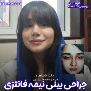 جراحی بینی نیمه فانتزی