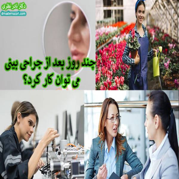 کار کردن بعد از جراحی بینی